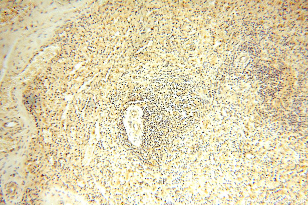 IHC staining of human spleen using 15753-1-AP