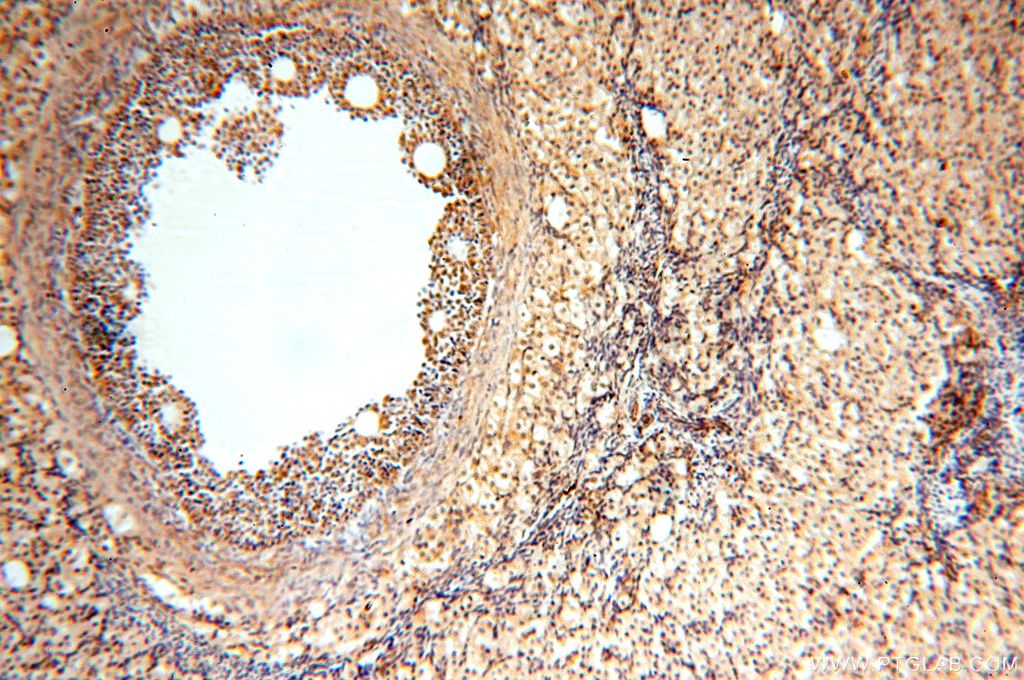Immunohistochemistry (IHC) staining of human ovary tissue using TRBP Polyclonal antibody (15753-1-AP)