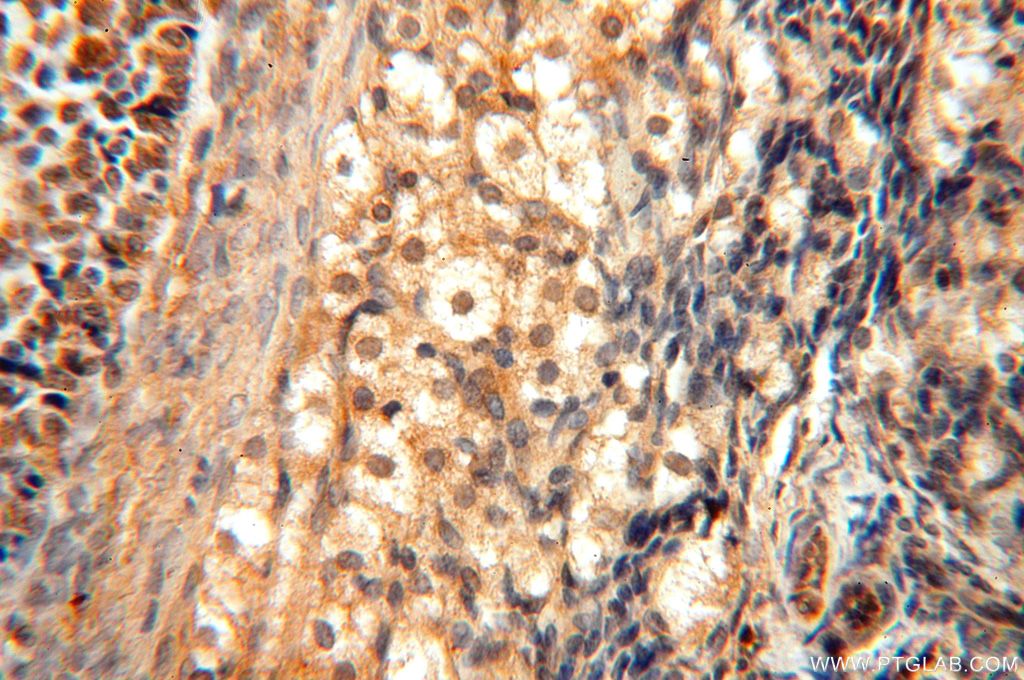 Immunohistochemistry (IHC) staining of human ovary tissue using TRBP Polyclonal antibody (15753-1-AP)
