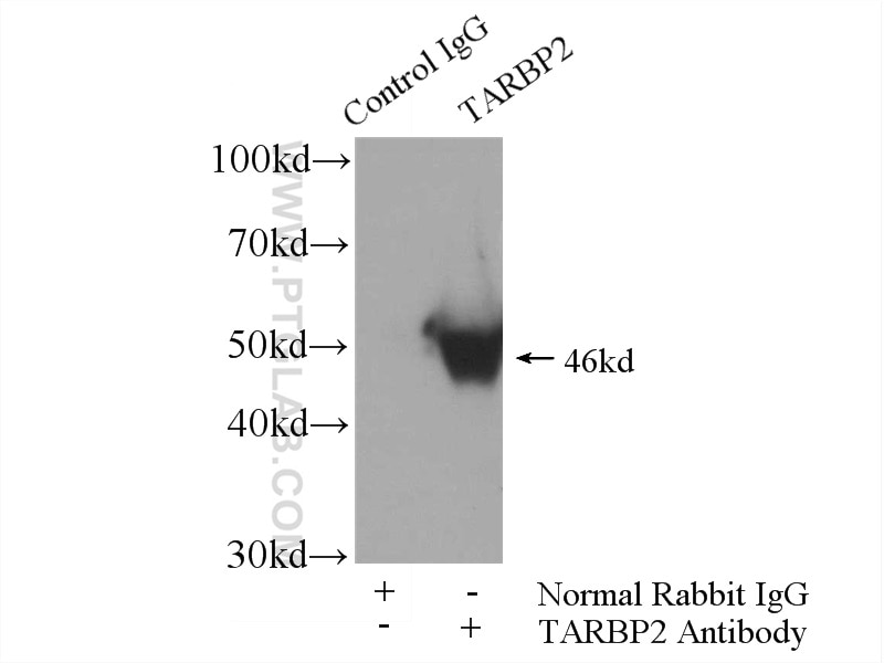Immunoprecipitation (IP) experiment of mouse liver tissue using TRBP Polyclonal antibody (15753-1-AP)