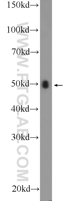 Western Blot (WB) analysis of mouse spleen tissue using TRBP Polyclonal antibody (15753-1-AP)