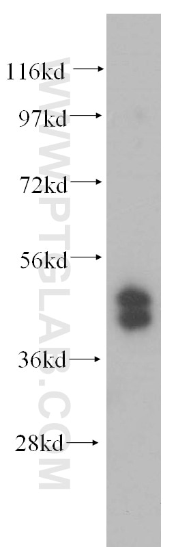 Western Blot (WB) analysis of HepG2 cells using TRBP Polyclonal antibody (15753-1-AP)