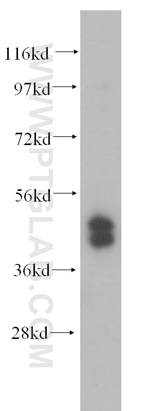 WB analysis of HepG2 using 15753-1-AP