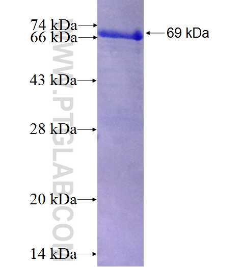 TRBP fusion protein Ag8255 SDS-PAGE