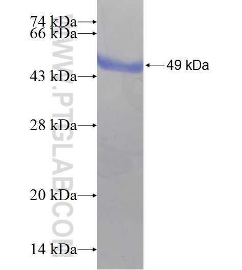 TRBP fusion protein Ag8269 SDS-PAGE