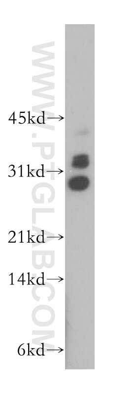 Western Blot (WB) analysis of U-937 cells using TRBV5-4 Polyclonal antibody (13524-1-AP)