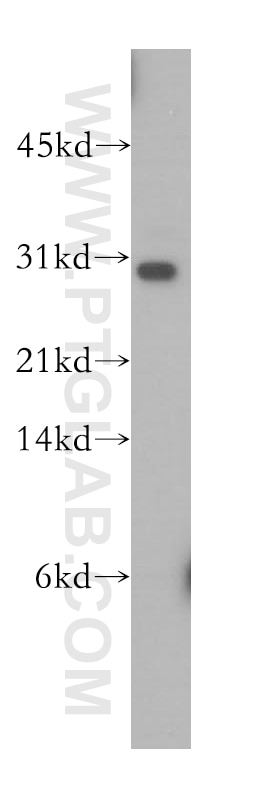 Western Blot (WB) analysis of U-937 cells using TRBV5-4 Polyclonal antibody (13524-1-AP)