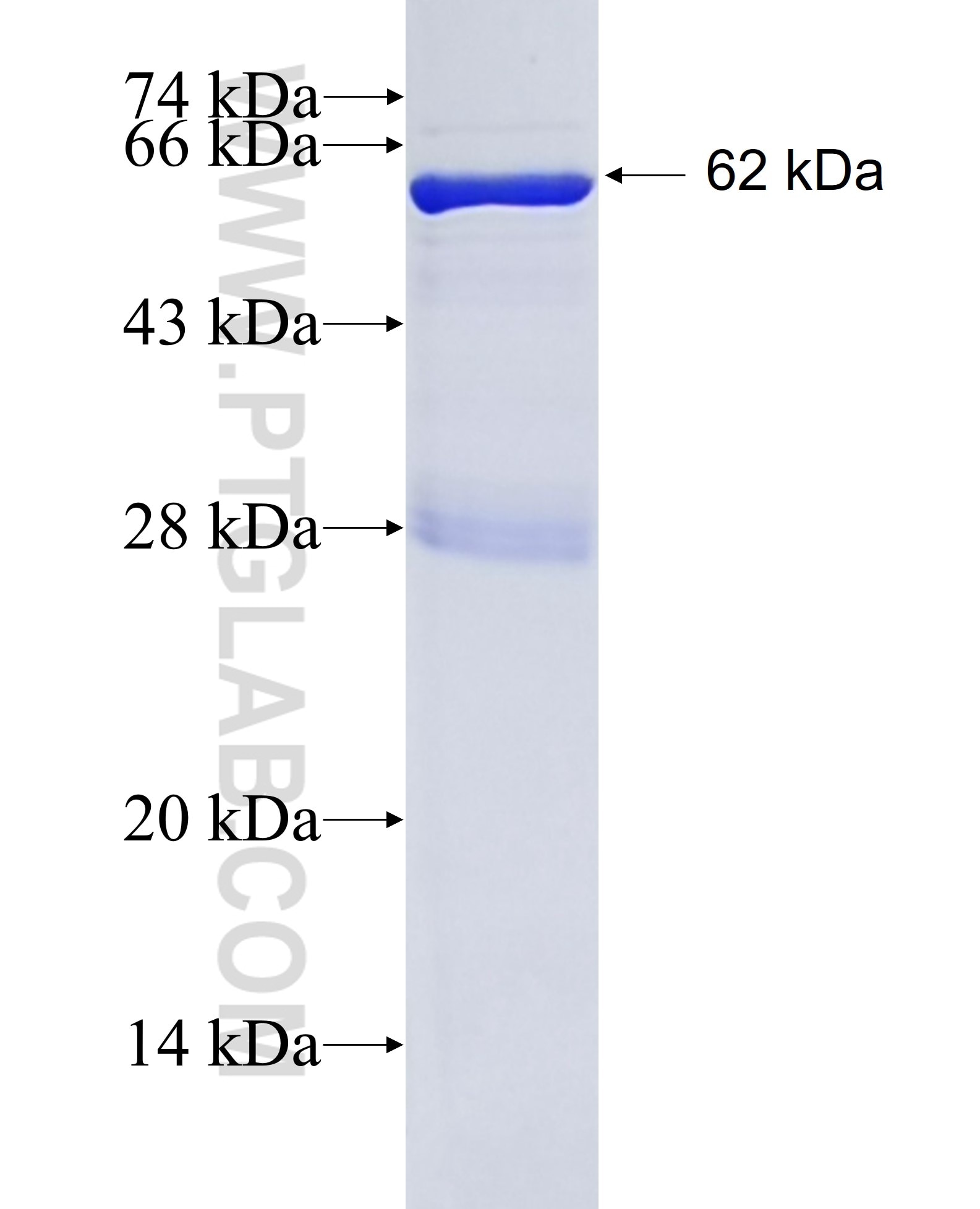 TREH fusion protein Ag16246 SDS-PAGE