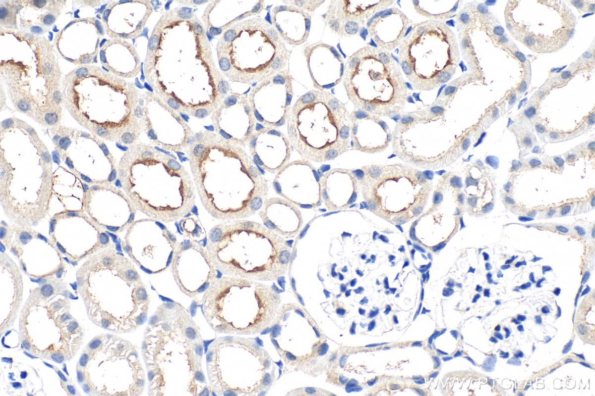 Immunohistochemistry (IHC) staining of mouse kidney tissue using TREK1/KCNK2 Polyclonal antibody (26807-1-AP)