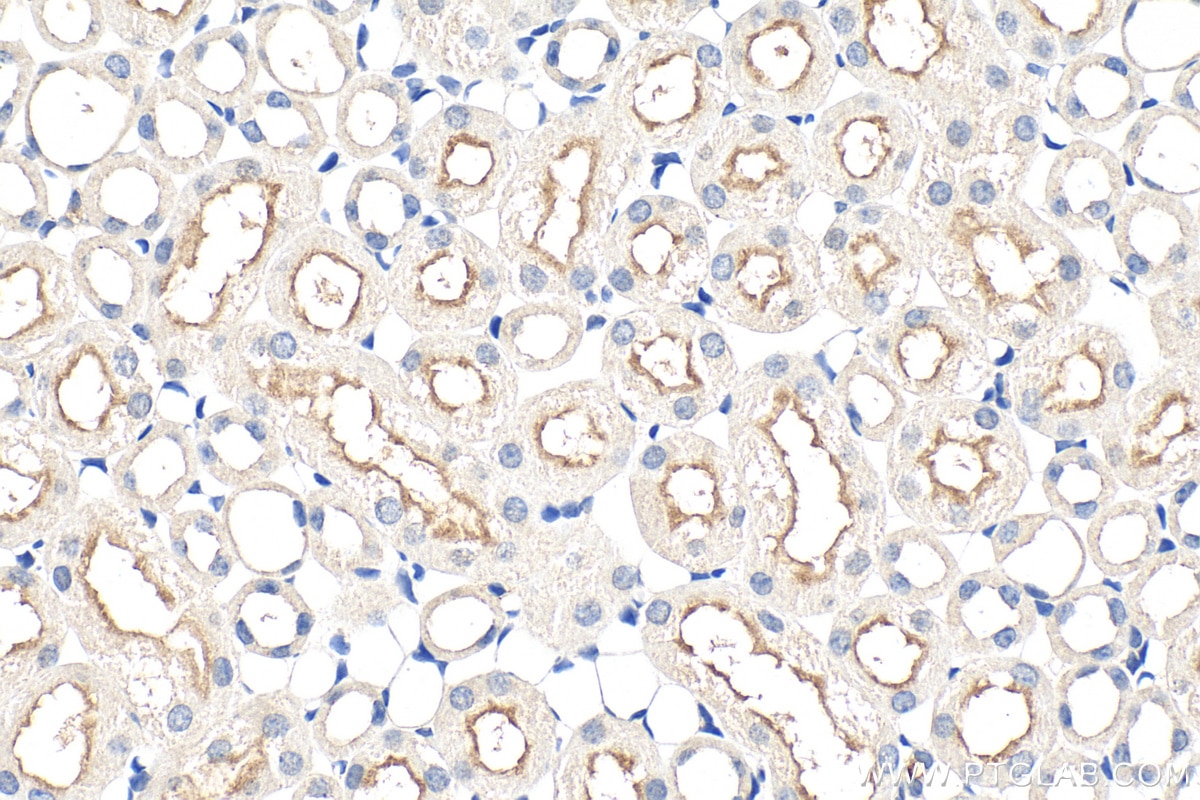 Immunohistochemistry (IHC) staining of mouse kidney tissue using TREK1/KCNK2 Polyclonal antibody (26807-1-AP)