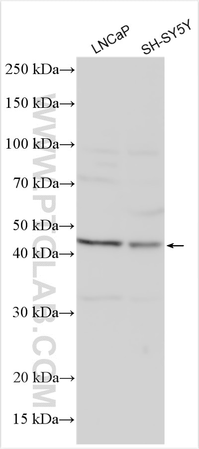 Western Blot (WB) analysis of various lysates using TREK1/KCNK2 Polyclonal antibody (26807-1-AP)