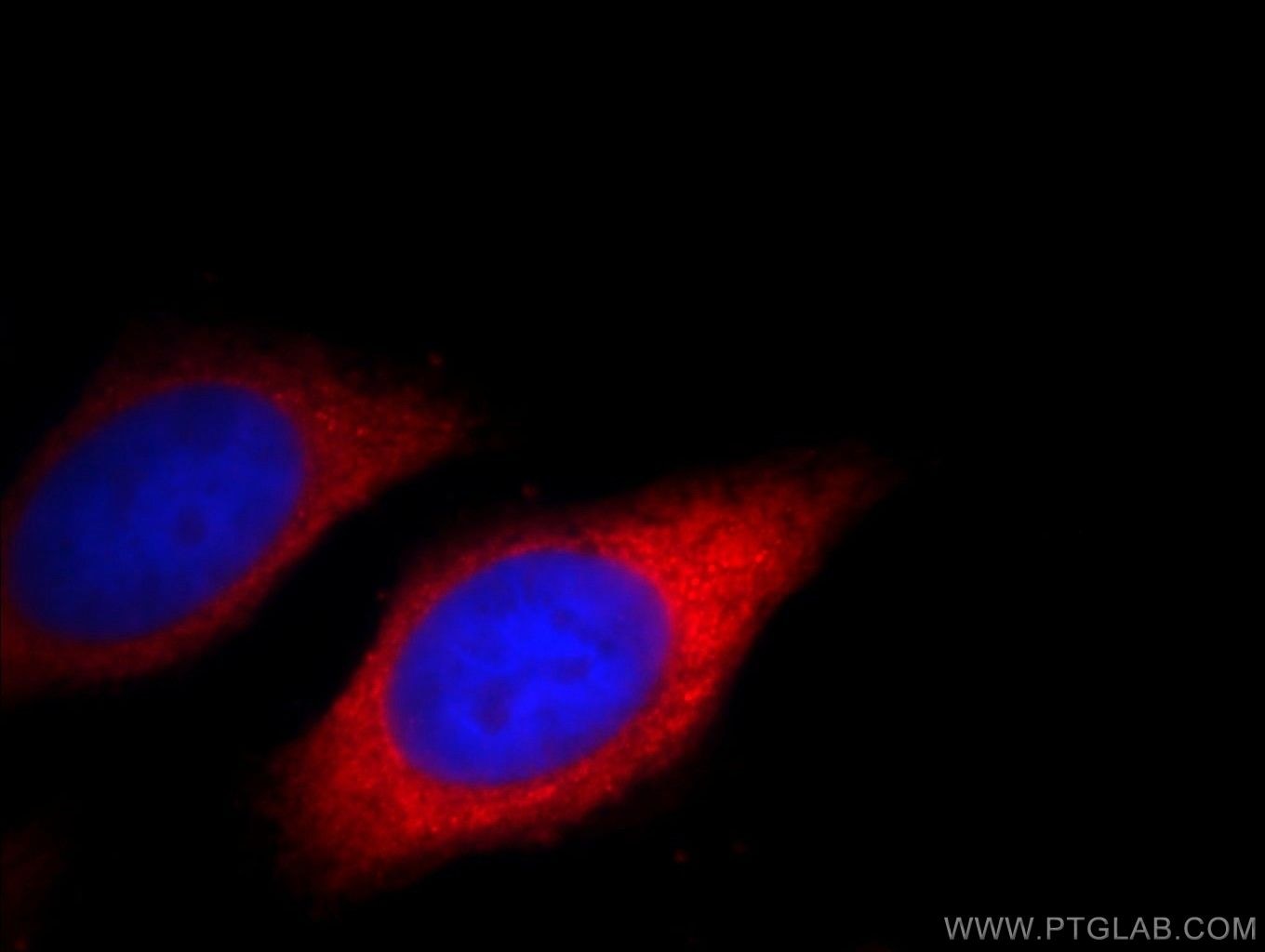 Immunofluorescence (IF) / fluorescent staining of HepG2 cells using TREM1 Polyclonal antibody (11791-1-AP)