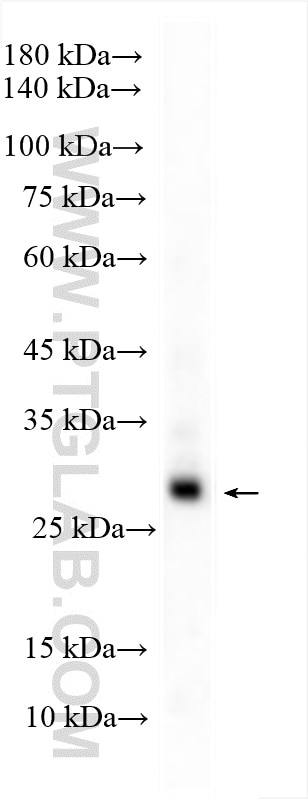 Western Blot (WB) analysis of human peripheral blood leukocyte using TREM1 Polyclonal antibody (11791-1-AP)