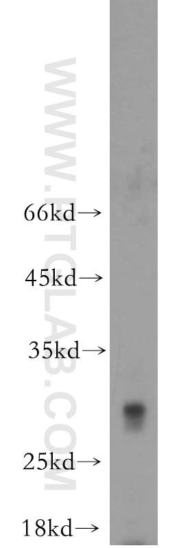 Western Blot (WB) analysis of human liver tissue using TREM1 Polyclonal antibody (11791-1-AP)