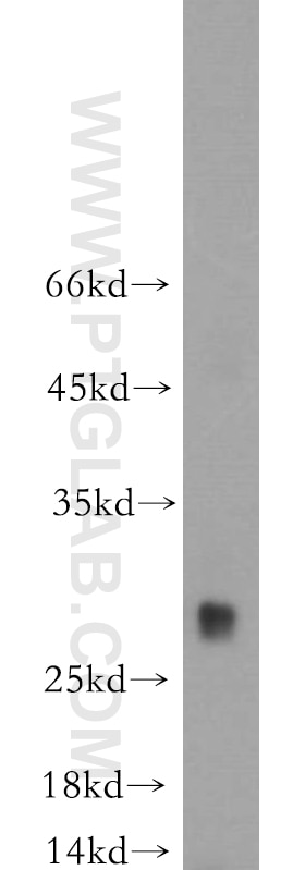 Western Blot (WB) analysis of mouse lung tissue using TREM1 Polyclonal antibody (11791-1-AP)