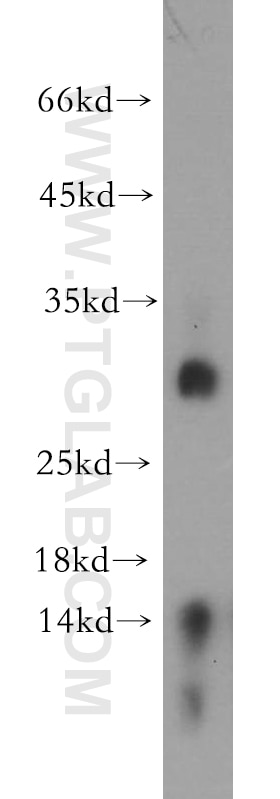 Western Blot (WB) analysis of human spleen tissue using TREM1 Polyclonal antibody (11791-1-AP)