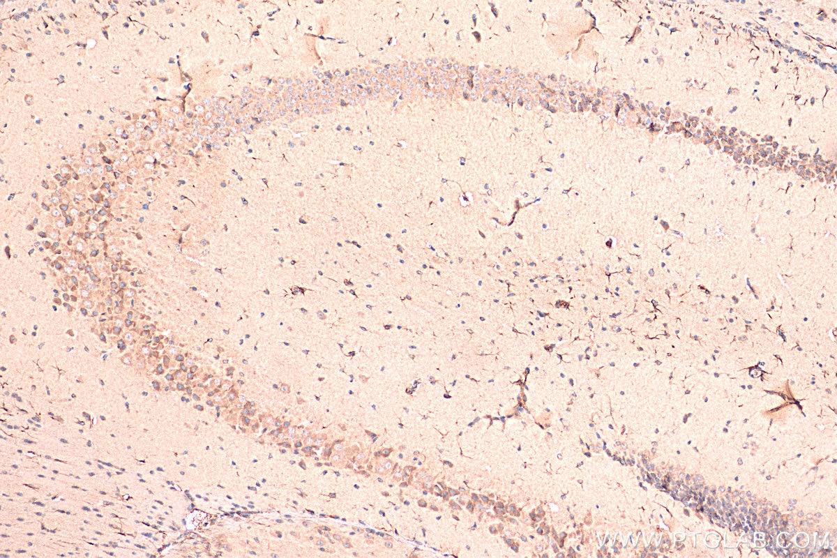 Immunohistochemistry (IHC) staining of mouse brain tissue using TREM2 Polyclonal antibody (13483-1-AP)