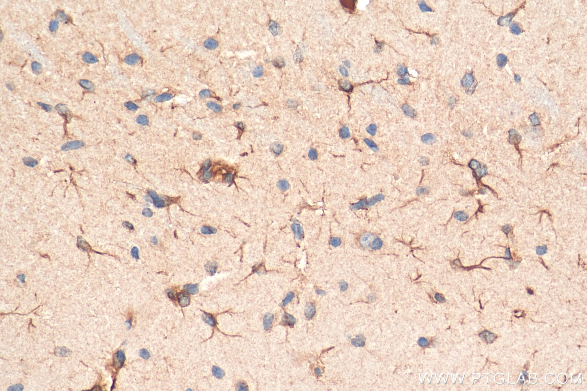 Immunohistochemistry (IHC) staining of mouse brain tissue using TREM2 Polyclonal antibody (13483-1-AP)