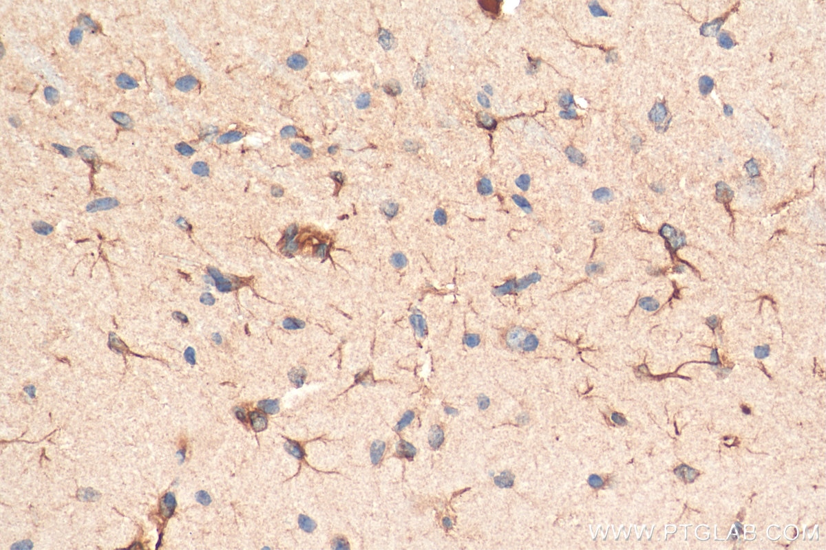 IHC staining of mouse brain using 13483-1-AP