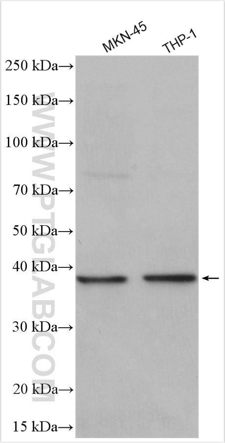Western Blot (WB) analysis of various lysates using TREM2 Polyclonal antibody (27599-1-AP)