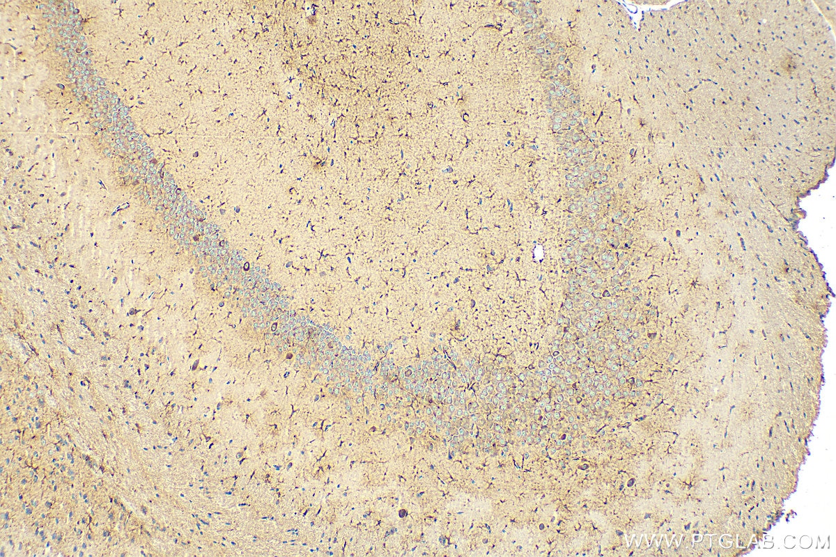 Immunohistochemistry (IHC) staining of mouse brain tissue using TREM2 Monoclonal antibody (68723-1-Ig)