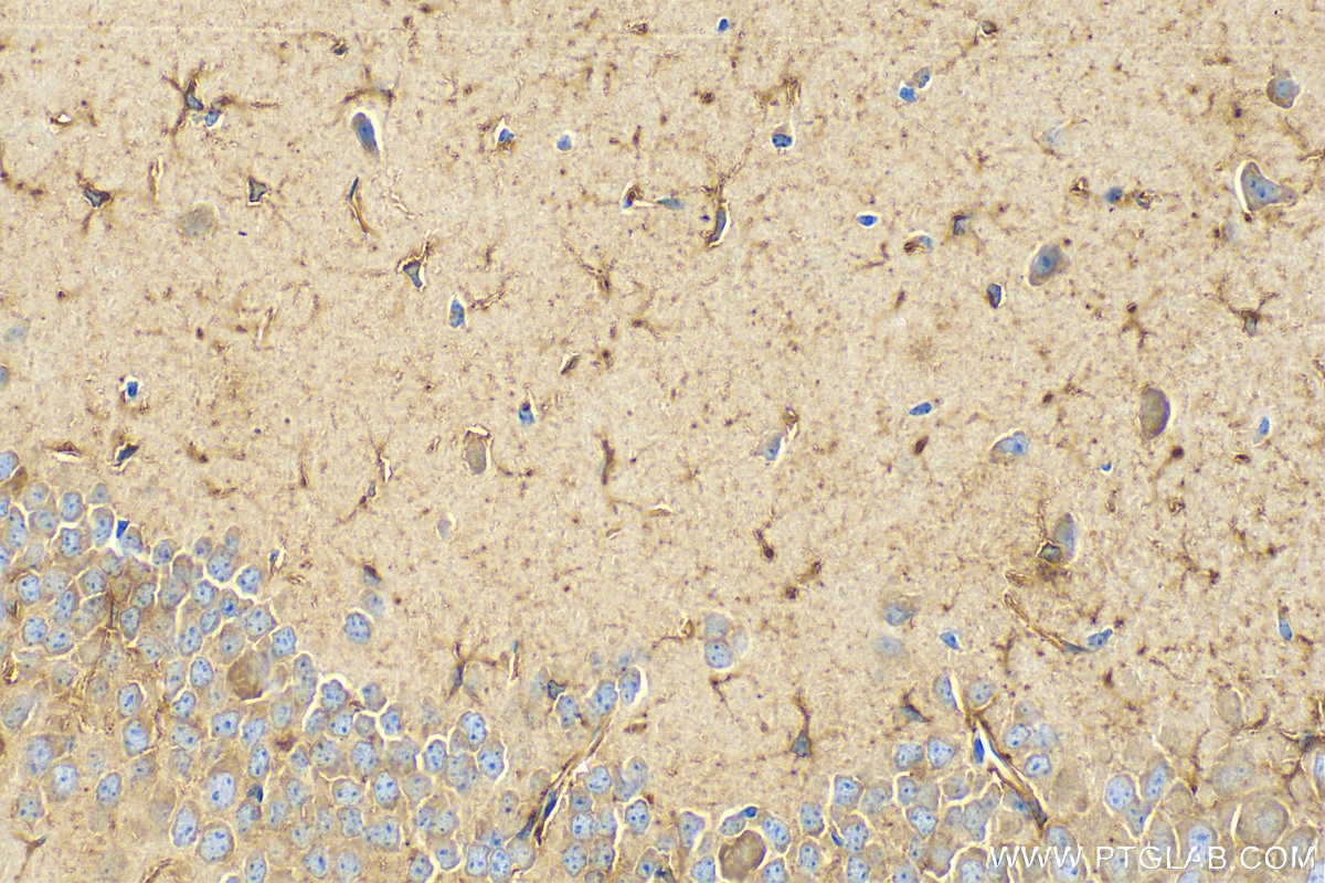 Immunohistochemistry (IHC) staining of mouse brain tissue using TREM2 Monoclonal antibody (68723-1-Ig)