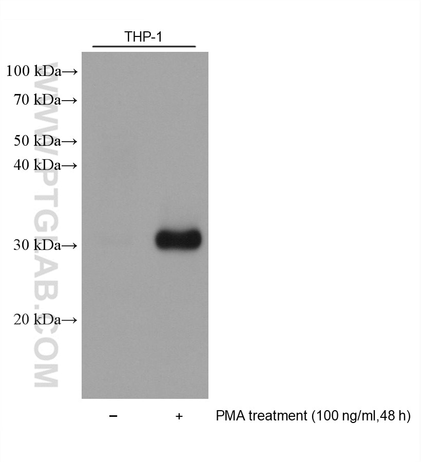 Western Blot (WB) analysis of various lysates using TREM2 Monoclonal antibody (68723-1-Ig)