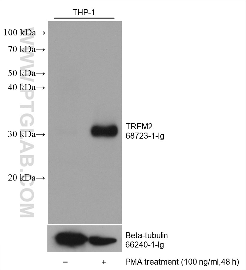 Western Blot (WB) analysis of various lysates using TREM2 Monoclonal antibody (68723-1-Ig)