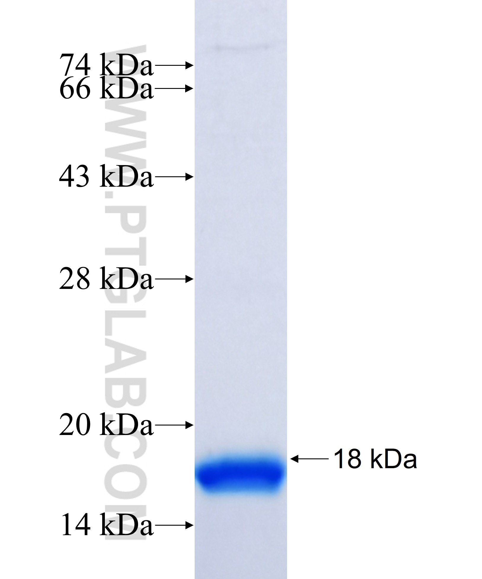 TREM2 fusion protein Ag30825 SDS-PAGE TREM2 fusion protein Ag30825 SDS-PAGE
