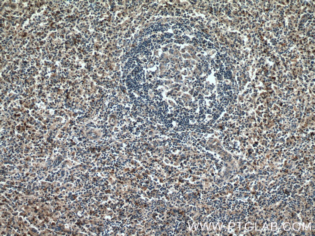 IHC staining of human spleen using 18056-1-AP