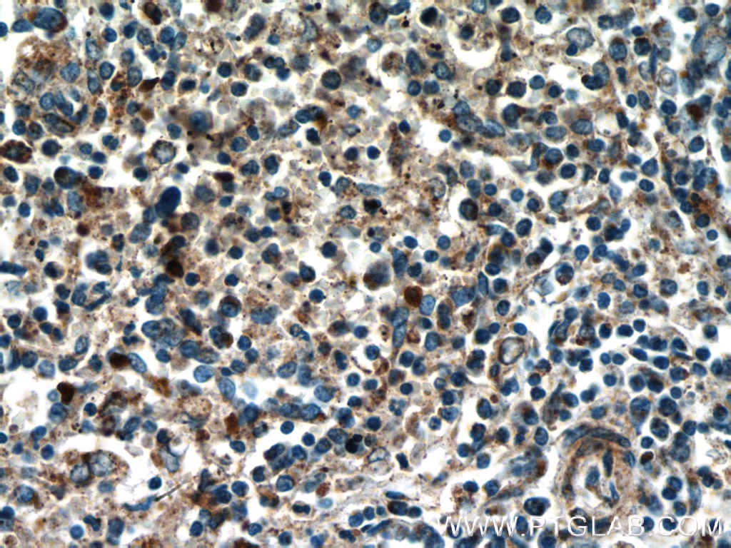 Immunohistochemistry (IHC) staining of human spleen tissue using TREML4 Polyclonal antibody (18056-1-AP)