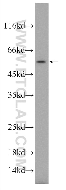 Western Blot (WB) analysis of HL-60 cells using TREML4 Polyclonal antibody (18056-1-AP)