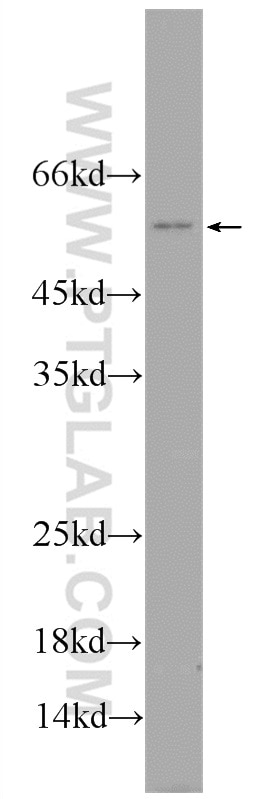 Western Blot (WB) analysis of U-937 cells using TREML4 Polyclonal antibody (18056-1-AP)