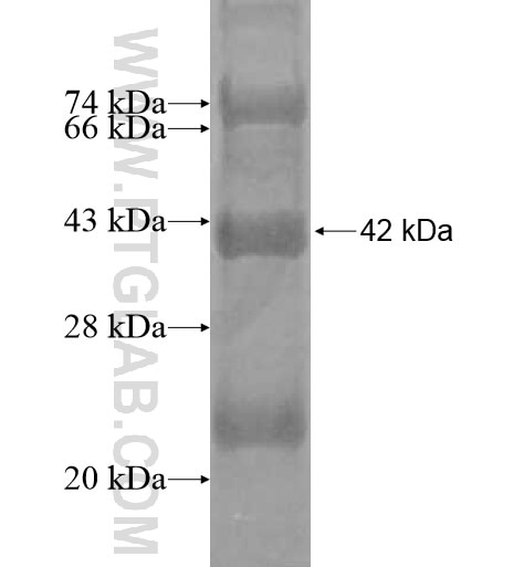 TREML4 fusion protein Ag12574 SDS-PAGE