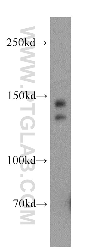 Western Blot (WB) analysis of MCF-7 cells using TRERF1 Polyclonal antibody (20062-1-AP)