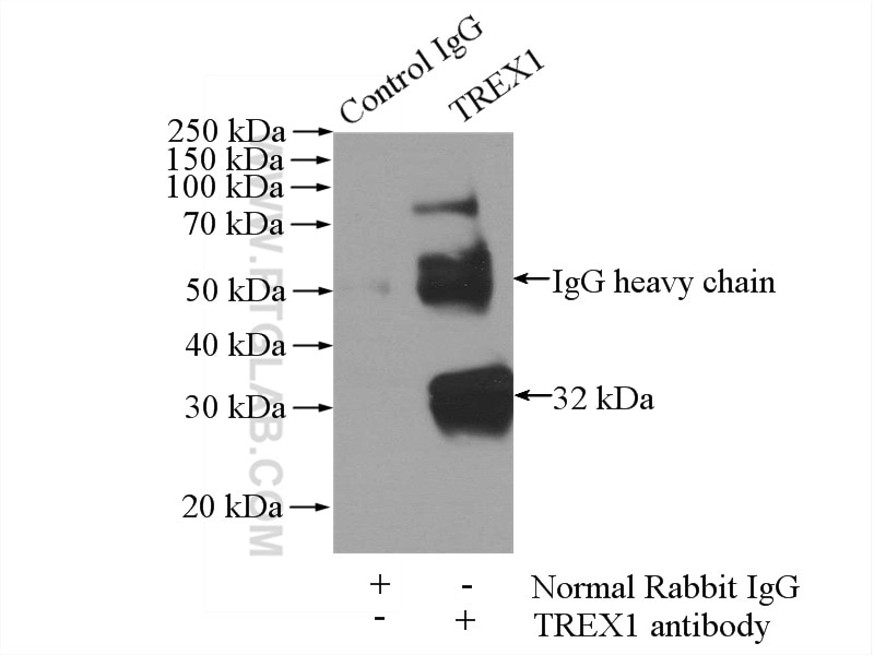 Immunoprecipitation (IP) experiment of HeLa cells using TREX1 Polyclonal antibody (24876-1-AP)