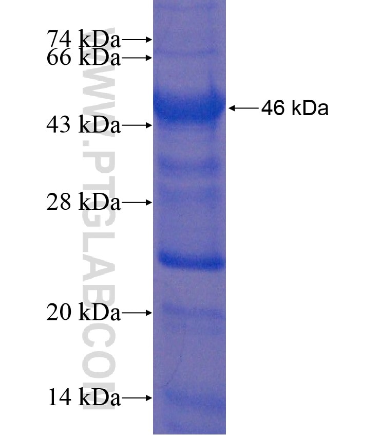 TREX1 fusion protein Ag18325 SDS-PAGE