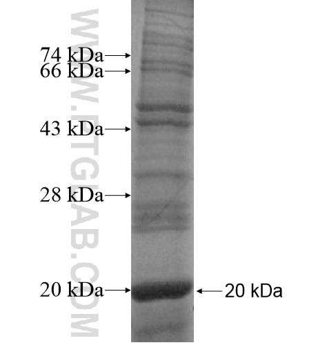 TRGV7 fusion protein Ag12376 SDS-PAGE