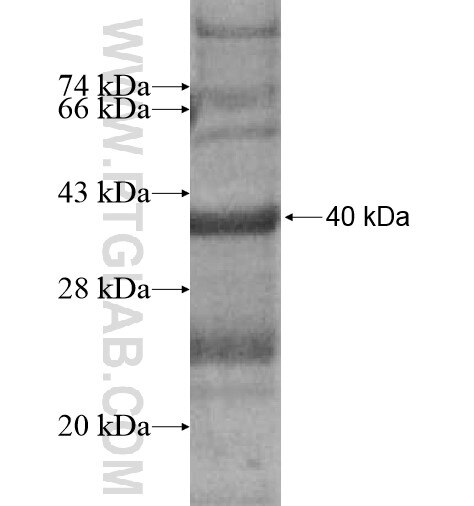 TRGV7 fusion protein Ag13472 SDS-PAGE