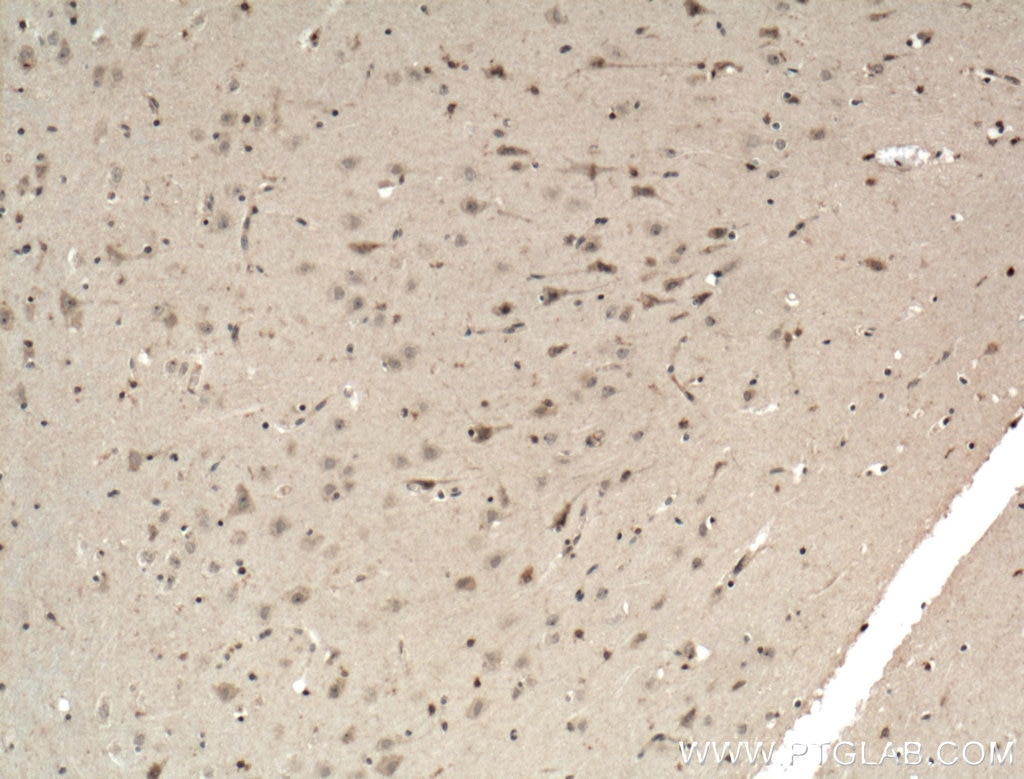 Immunohistochemistry (IHC) staining of human brain tissue using TRH Polyclonal antibody (25332-1-AP)