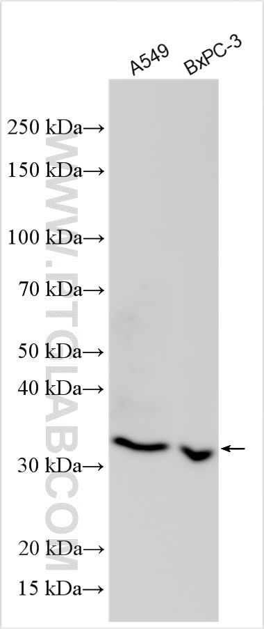 Western Blot (WB) analysis of various lysates using TRH Polyclonal antibody (25332-1-AP)