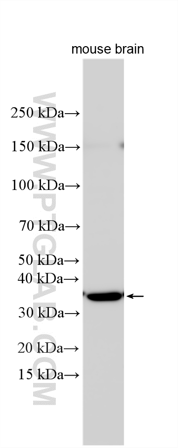WB analysis using 23872-1-AP Western Blot (WB) analysis of various lysates using TRHR Polyclonal antibody (23872-1-AP)