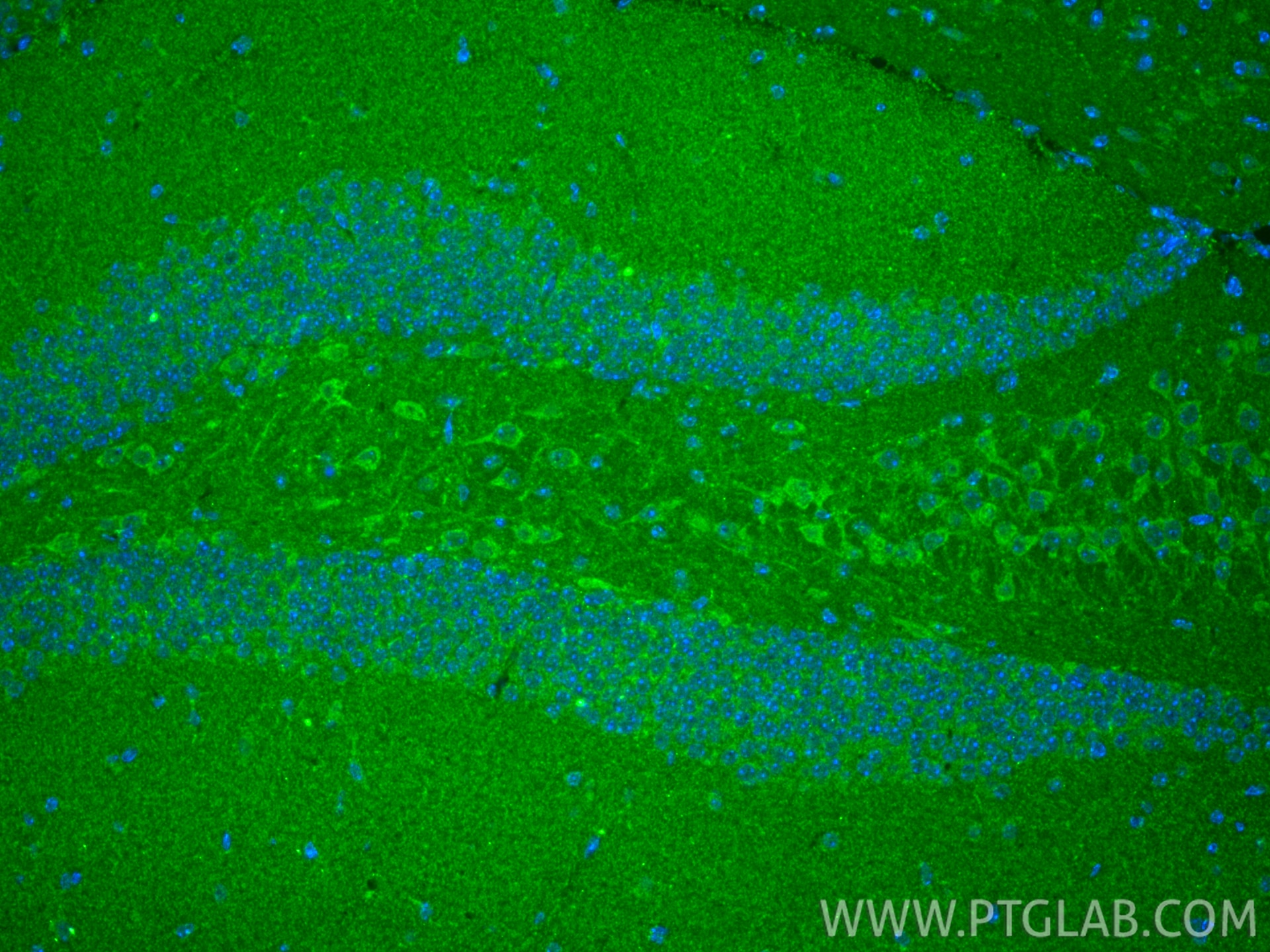 Immunofluorescence (IF) / fluorescent staining of mouse brain tissue using TRIAP1 Polyclonal antibody (15351-1-AP)