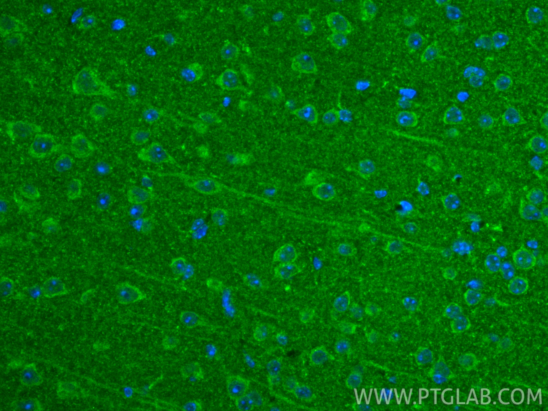 Immunofluorescence (IF) / fluorescent staining of mouse brain tissue using TRIAP1 Polyclonal antibody (15351-1-AP)