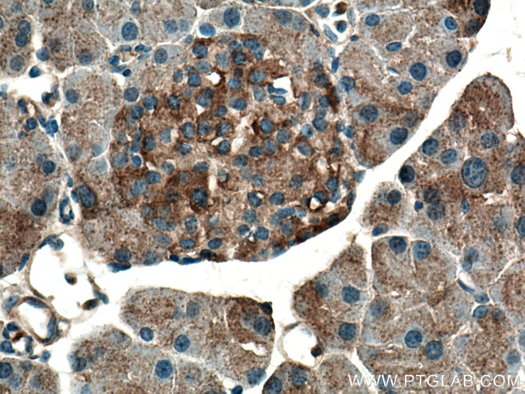 Immunohistochemistry (IHC) staining of mouse pancreas tissue using TRIAP1 Polyclonal antibody (15351-1-AP)