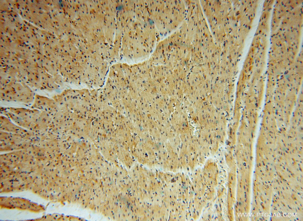 Immunohistochemistry (IHC) staining of human heart tissue using TRIB2 Polyclonal antibody (15359-1-AP)