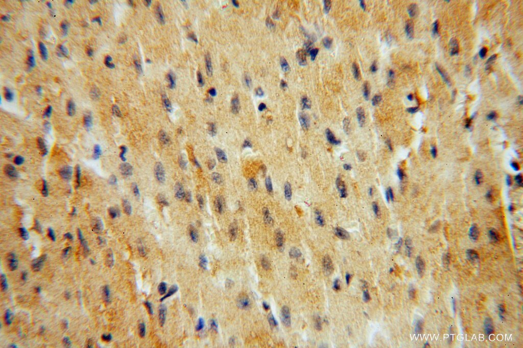 Immunohistochemistry (IHC) staining of human heart tissue using TRIB2 Polyclonal antibody (15359-1-AP)