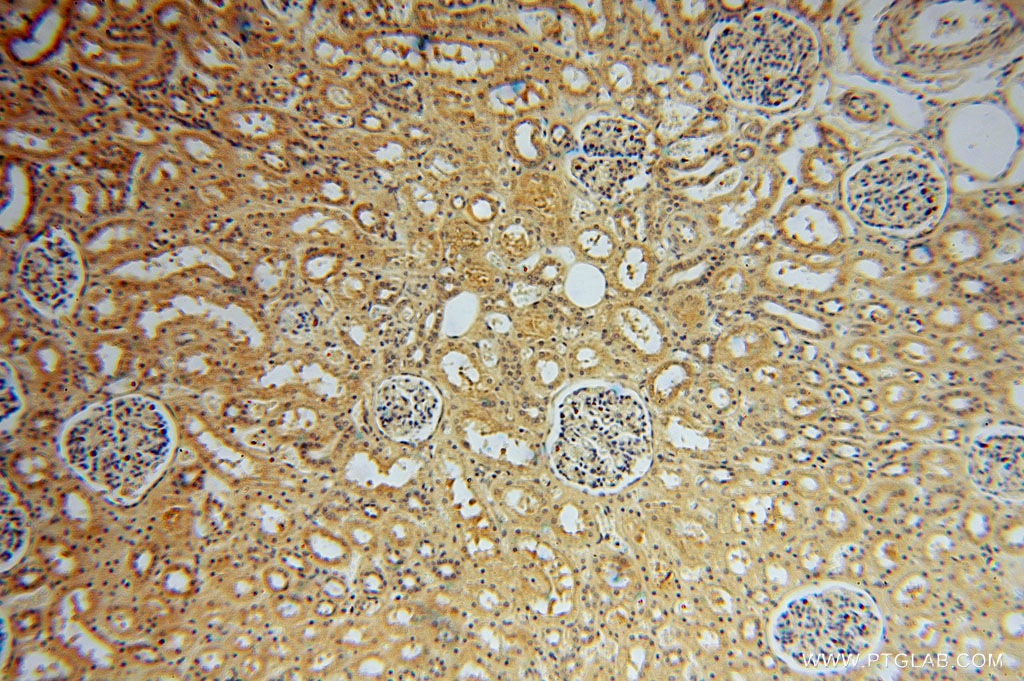 Immunohistochemistry (IHC) staining of human kidney tissue using TRIB2 Polyclonal antibody (15359-1-AP)