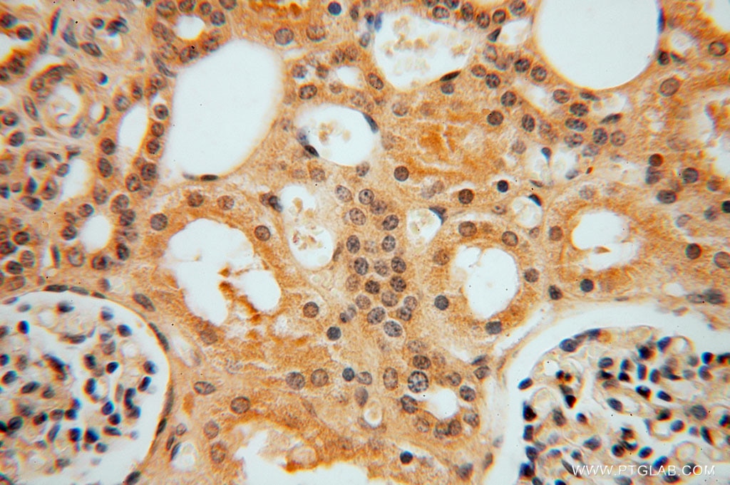 Immunohistochemistry (IHC) staining of human kidney tissue using TRIB2 Polyclonal antibody (15359-1-AP)