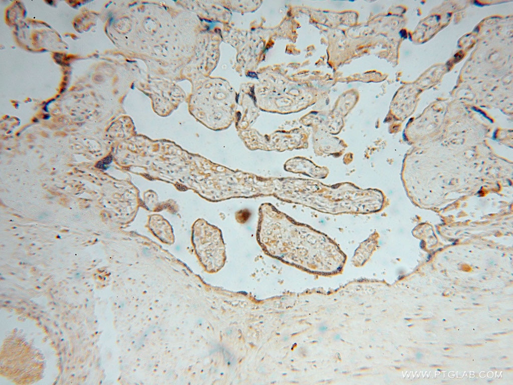 Immunohistochemistry (IHC) staining of human placenta tissue using TRIB2 Polyclonal antibody (15359-1-AP)